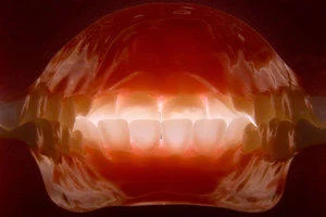 Improving Your Image: Dental Photography in Practice