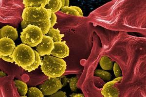 Antimicrobial Stewardship: Managing Antibiotic Resistance