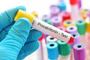 Procalcitonin: PCT as a Biomarker for Antimicrobial Stewardship