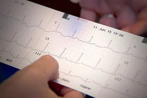 ECG Assessment: an Introduction for Healthcare Providers